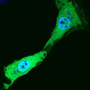 SVG-A glial cells transiently transfected with mEmerald clathrin (green) prior to fixation. Nuclei are stained with DAPI (blue). Courtesy of Colleen Mayberry and Melissa Maginnis, University of Maine.