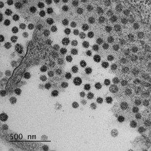 Electron micrograph of Vero E6 cells infected with SARS-CoV-2, 10 h post infection. Virus particles released from and associated with the plasma membrane. See Ogando et al., “SARS-Coronavirus-2 Replication in Vero E6 Cells: Replication Kinetics, Rapid Adaptation, and Cytopathology.” 2020. J. Gen. Virol. doi: 10.1099/jgv.0.001453 PMID 32568027. Courtesy of Ronald Limpens, Montse Bárcena and Eric Snijder, Leiden University Medical Center, the Netherlands.