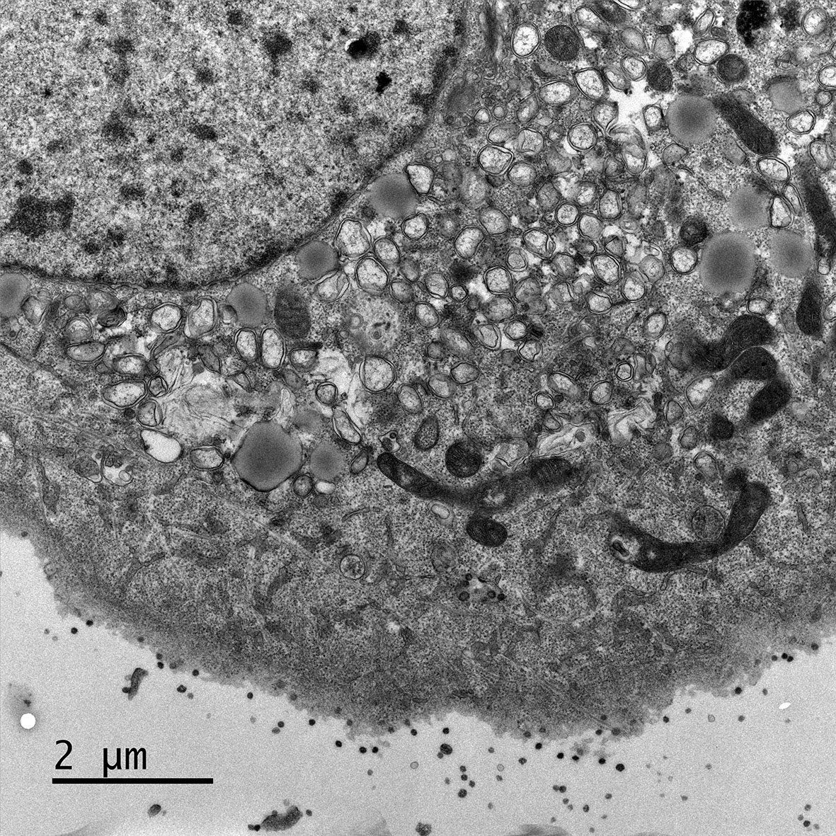 Electron micrograph of Vero E6 cells infected with SARS-CoV-2, 8 h post infection. Viral replication organelles. These virus-induced structures accumulate in large clusters in the perinuclear region and primarily contain double-membrane vesicles (DMVs).  See Ogando et al., “SARS-Coronavirus-2 Replication in Vero E6 Cells: Replication Kinetics, Rapid Adaptation, and Cytopathology.” 2020. J. Gen. Virol. doi: 10.1099/jgv.0.001453 PMID 32568027. Courtesy of Ronald Limpens, Montse Bárcena and Eric Snijder, Leiden University Medical Center, the Netherlands.