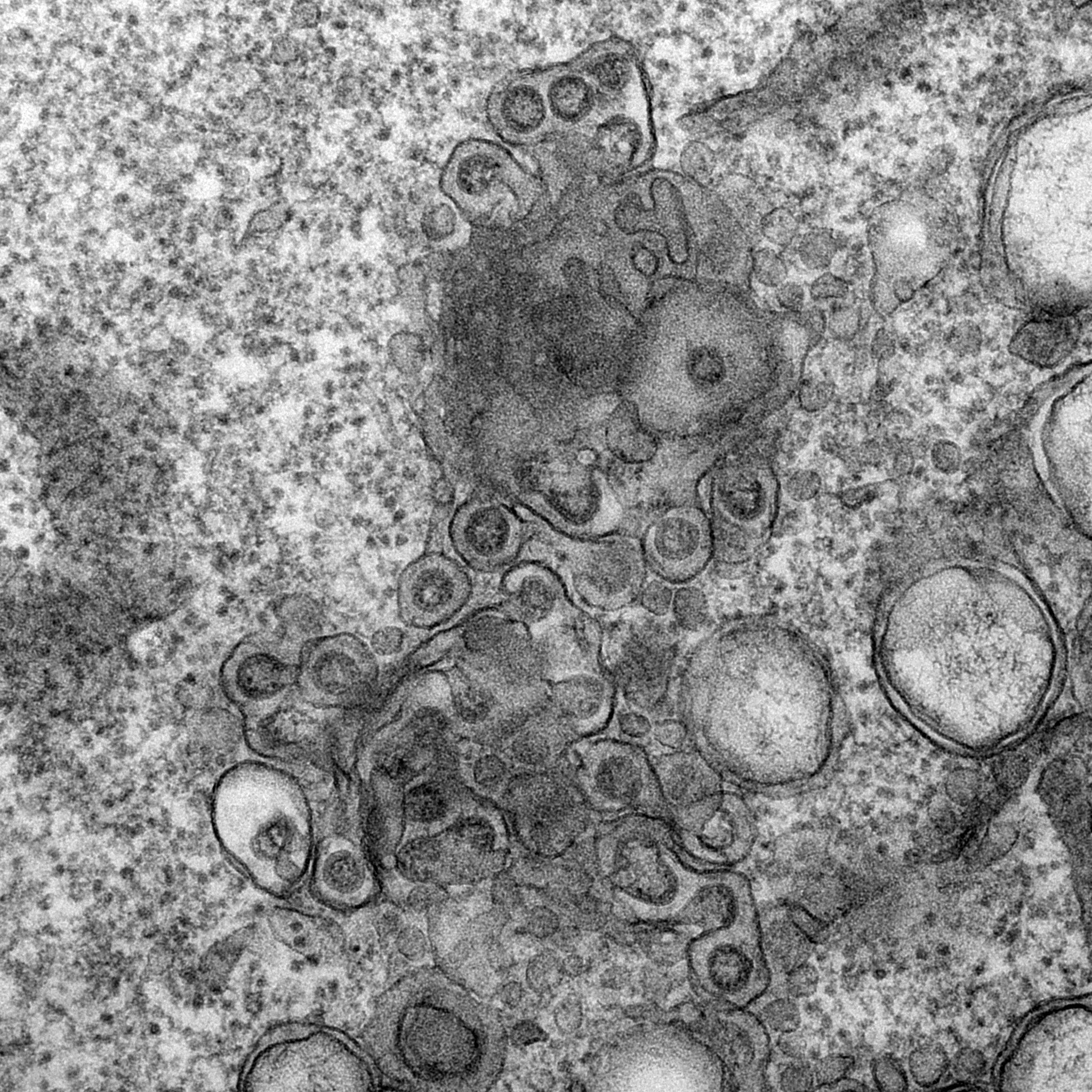 Electron micrograph of Vero E6 cells infected with SARS-CoV-2, 10 h post infection. Virus particles budding into membranes of the ERGIC. See Ogando et al., “SARS-Coronavirus-2 Replication in Vero E6 Cells: Replication Kinetics, Rapid Adaptation, and Cytopathology.” 2020. J. Gen. Virol. doi: 10.1099/jgv.0.001453 PMID 32568027. Courtesy of Ronald Limpens, Montse Bárcena and Eric Snijder, Leiden University Medical Center, the Netherlands.