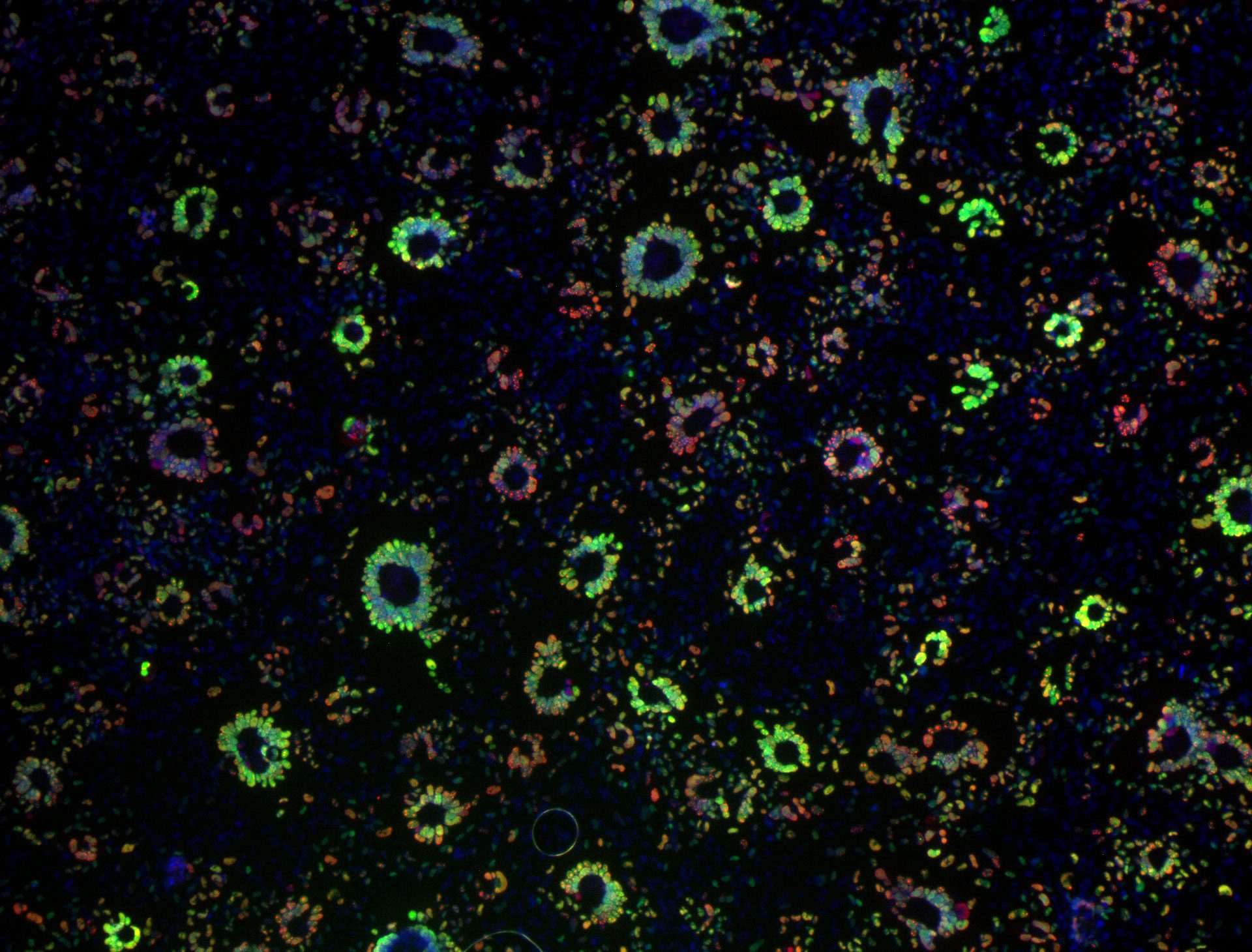 Epithelial cell monolayer (ARPE-19) infected with human cytomegalovirus, costained for viral immediate-early proteins 1/2 (green) and viral single-stranded DNA binding protein UL57 (red). Nuclei are stained with Hoechst 33342 (blue). See Vo, M., A. Aguiar, M.A. McVoy, and L. Hertel. 2020. Cytomegalovirus Strain TB40/E Restrictions and Adaptations to Growth in ARPE-19 Epithelial Cells. Microorganisms 8:E615. doi: 10.3390/microorganisms8040615. Courtesy of Alexis Aguiar and Laura Hertel, UC San Francisco.