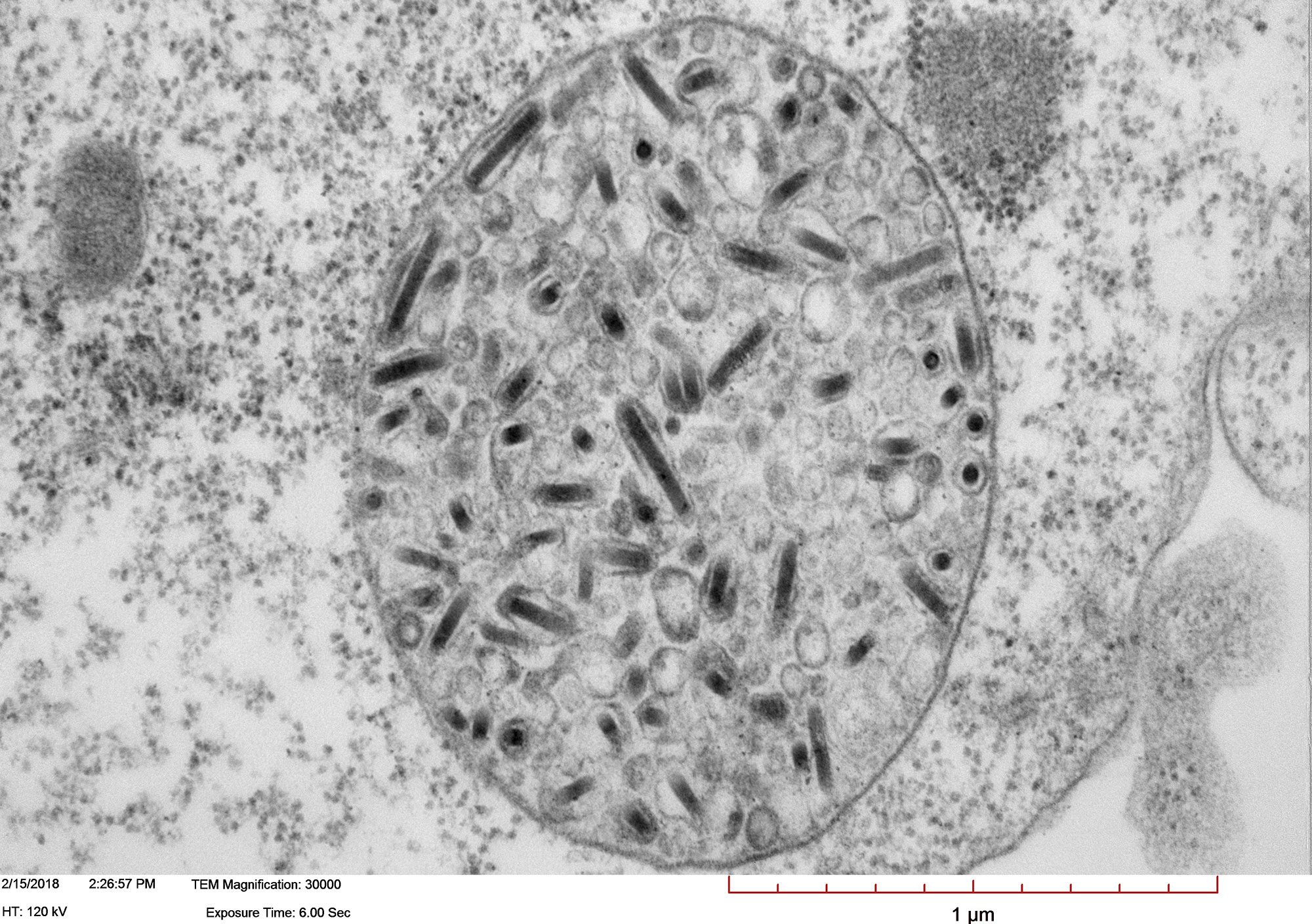 Transmission electron micrograph of High Five cells infected with Autographa californica multiple nucleopolyhedrovirus (AcMNPV). Image shows a large vesicle containing more than one enveloped nucleocapsid. Courtesy of Xiao-Wen Cheng, Miami University.